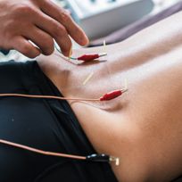 Electro-acupuncture Okotoks & Foothills